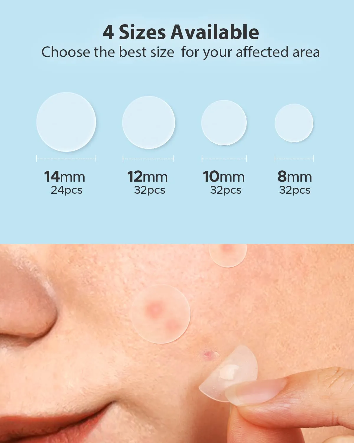 LitBear Acne Pimple Patches- Day and Night 4 Sizes 180 Dots Thin & Thick Hydrocolloid Patches with Witch Hazel, Tea Tree & Calendula Oil, Extra Adhesion for Face Zit Patch Dots